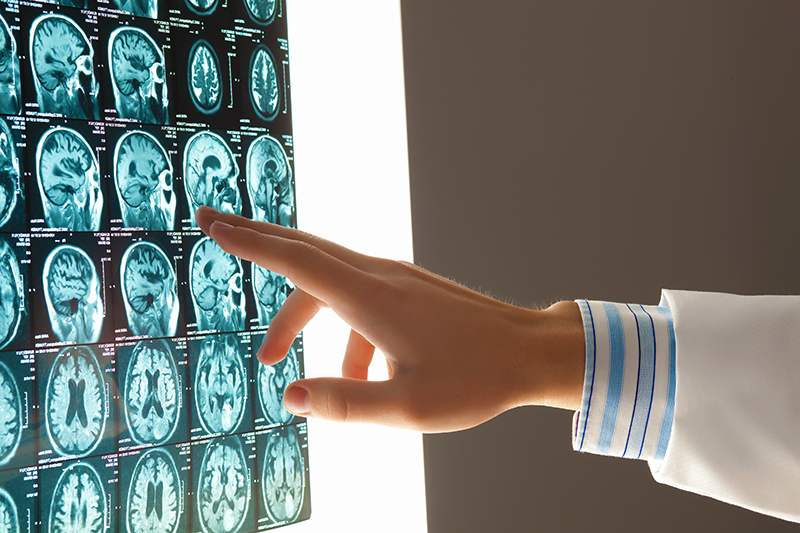 Tampa Brain Injury Attorney Tampa Brain Injury Attorney